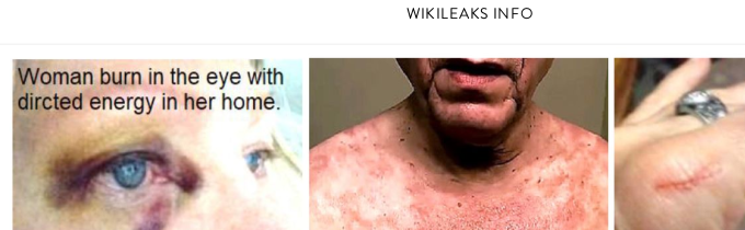 Wikileaks: Personen mit Verletzungen durch Waffen des verdeckten Kampfes