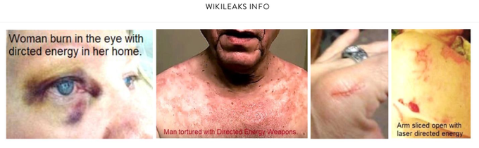 Wikileaks: Personen mit Verletzungen durch Waffen des verdeckten Kampfes